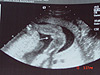 Picture showing it's a girl!
